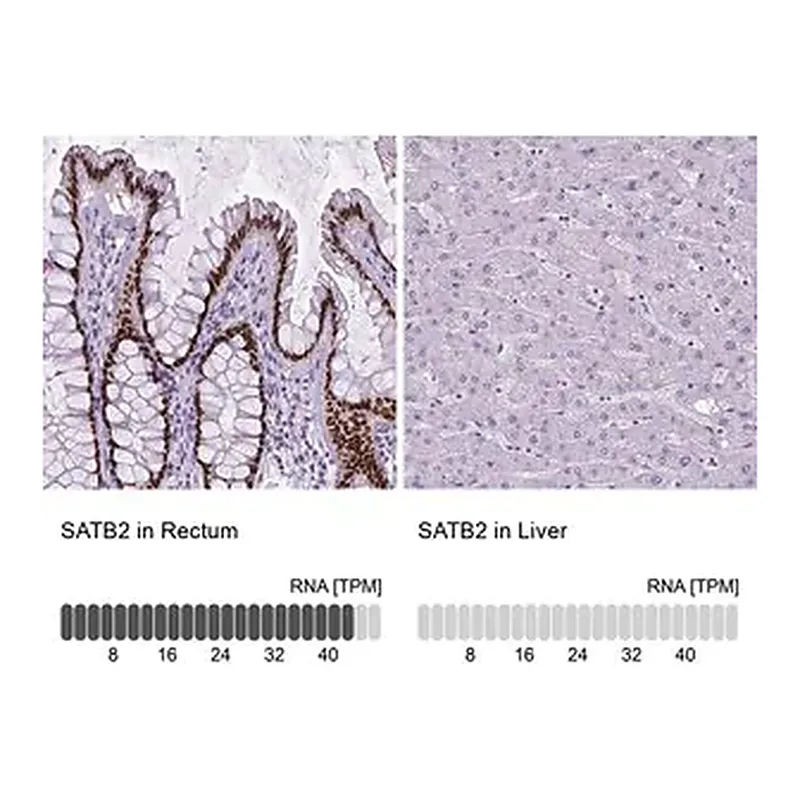 Merck Monoclonal Anti-SATB2 antibody produced in mouse