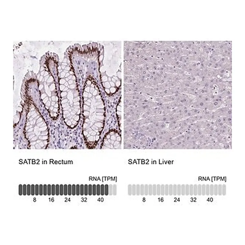 Merck Monoclonal Anti-SATB2 antibody produced in mouse