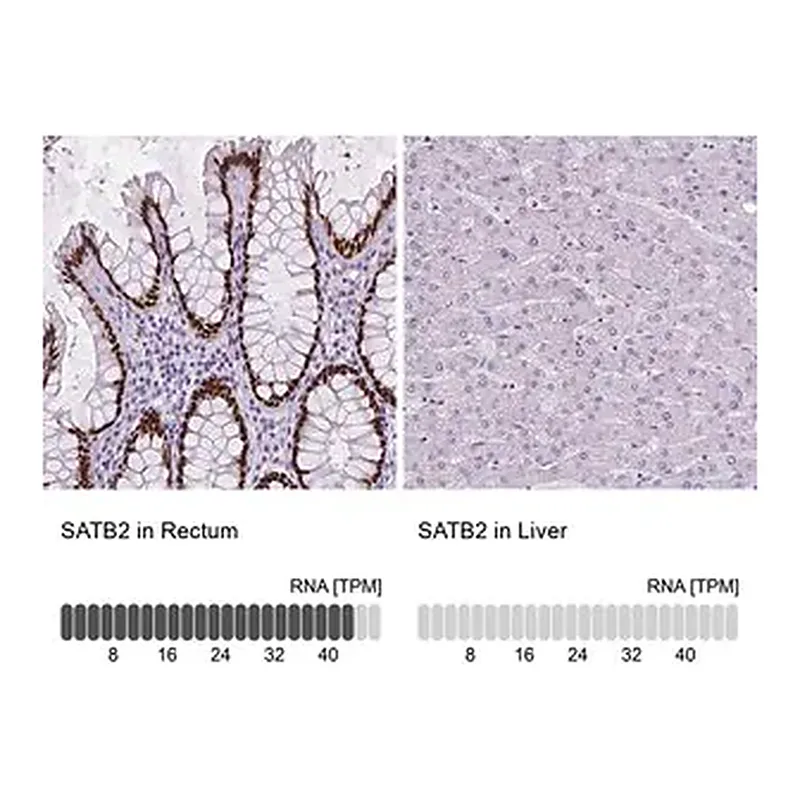 Merck Monoclonal Anti-SATB2 antibody produced in mouse