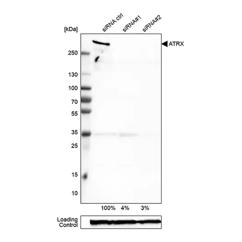Merck Monoclonal Anti-ATRX antibody produced in mouse