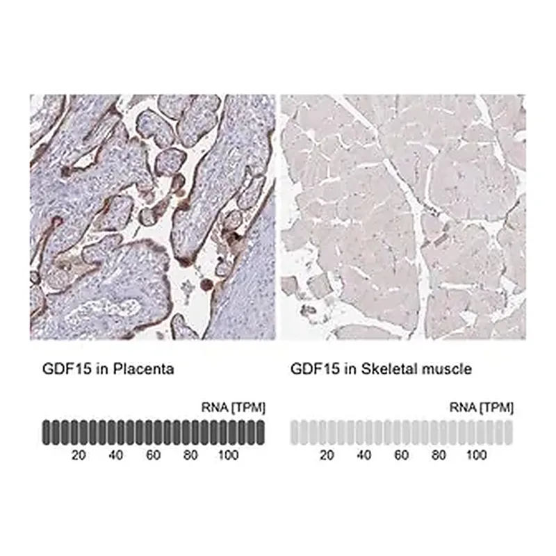 Merck Monoclonal Anti-GDF15 antibody produced in mouse