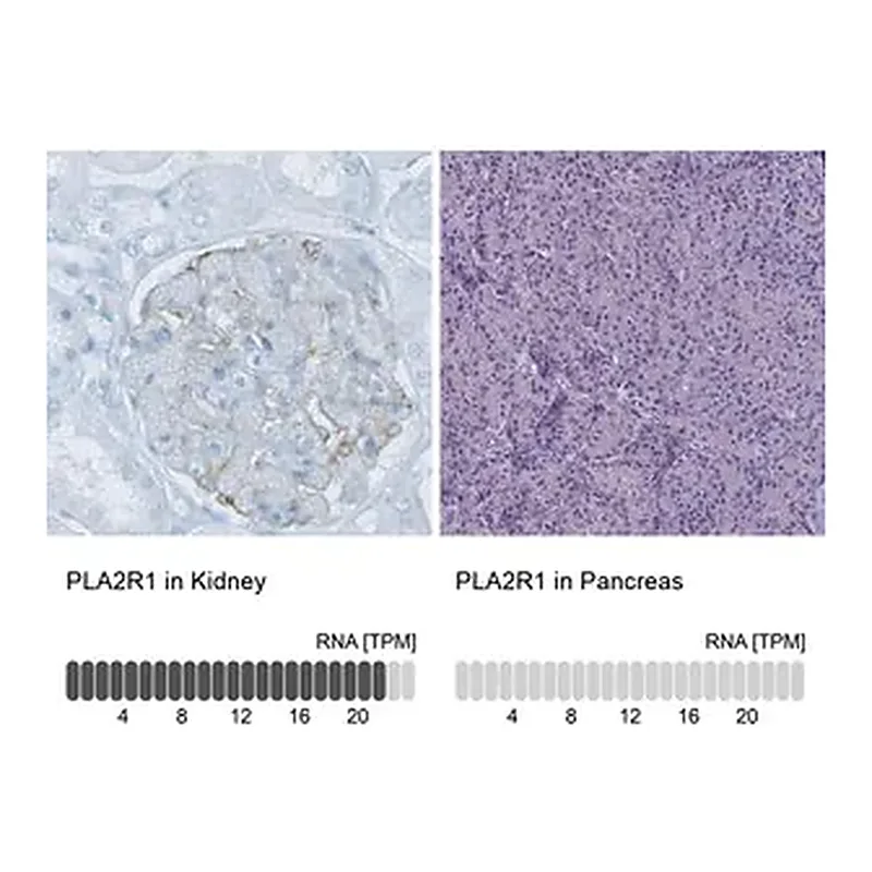 Merck Monoclonal Anti-PLA2R1 antibody produced in mouse