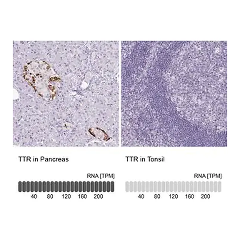 Merck Monoclonal Anti-TTR antibody produced in mouse