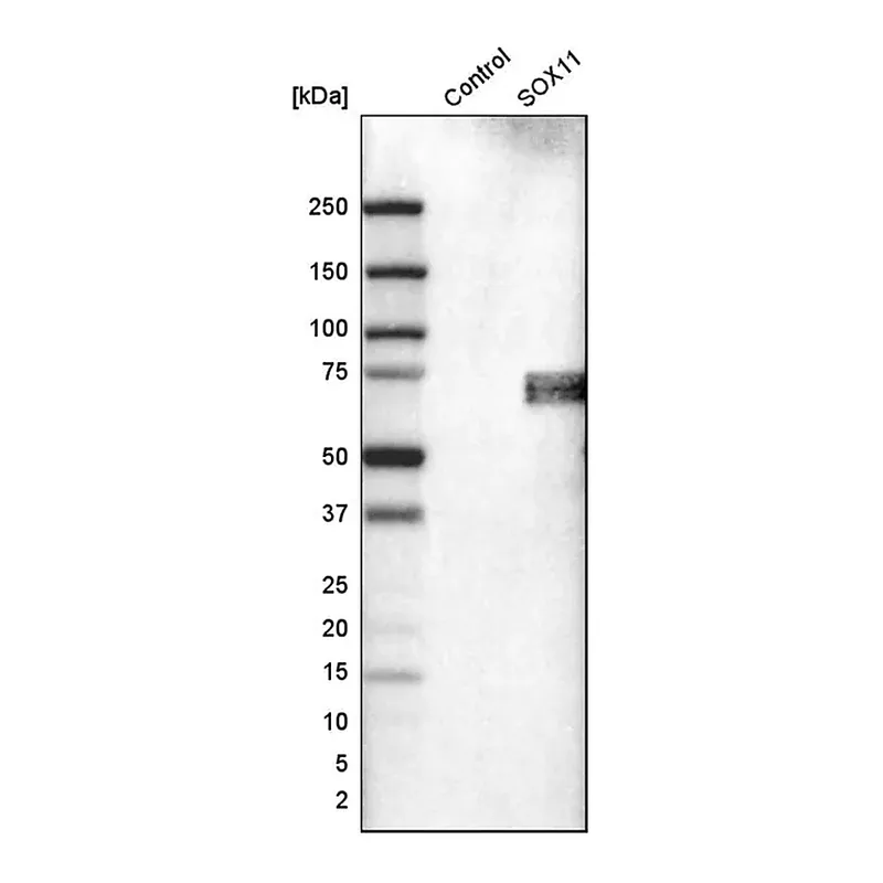Merck Monoclonal Anti-SOX11 antibody produced in mouse