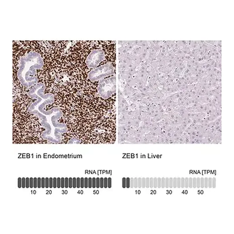 Merck Monoclonal Anti-ZEB1 antibody produced in mouse