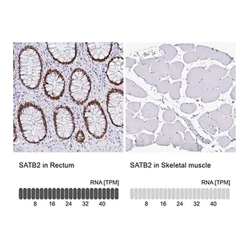 Merck Monoclonal Anti-SATB2 antibody produced in mouse