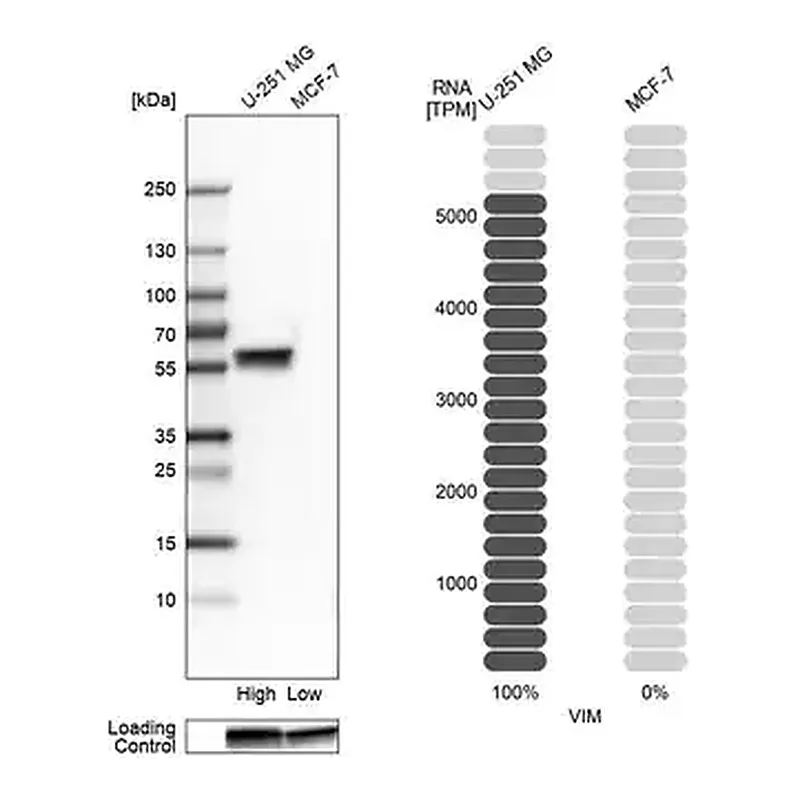 Merck Monoclonal Anti-VIM antibody produced in mouse