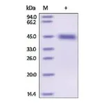 Merck Kallikrein-1 human