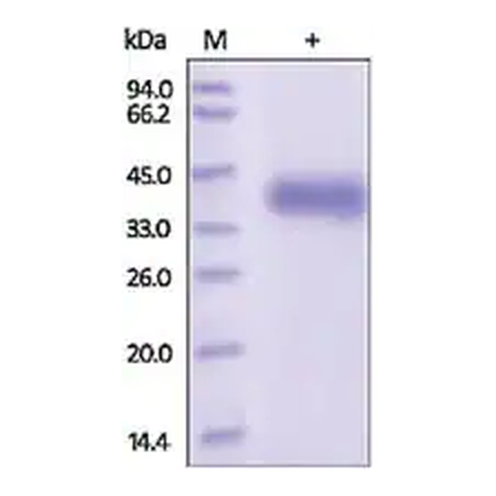 Merck Kallikrein-11 human
