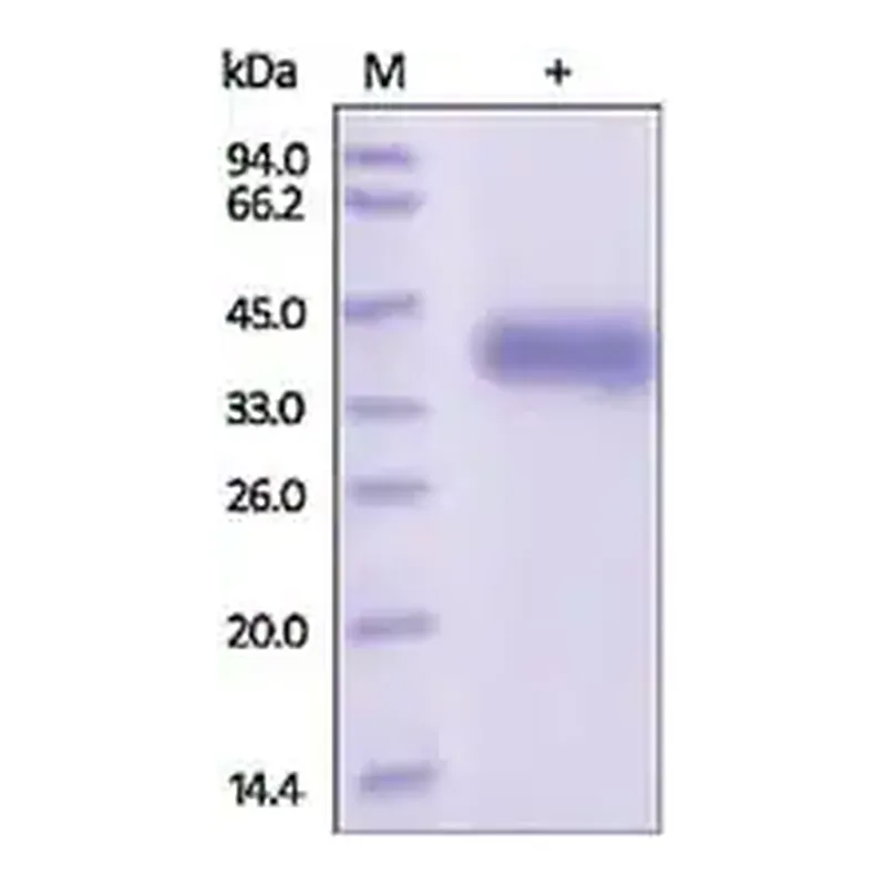 Merck Kallikrein-11 human