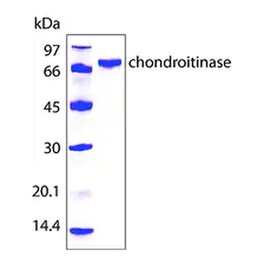 Merck Chondroitinase AC from Flavobacterium heparinum