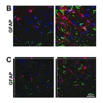 Merck Anti-Glial Fibrillary Acidic Protein Antibody, clone GA5