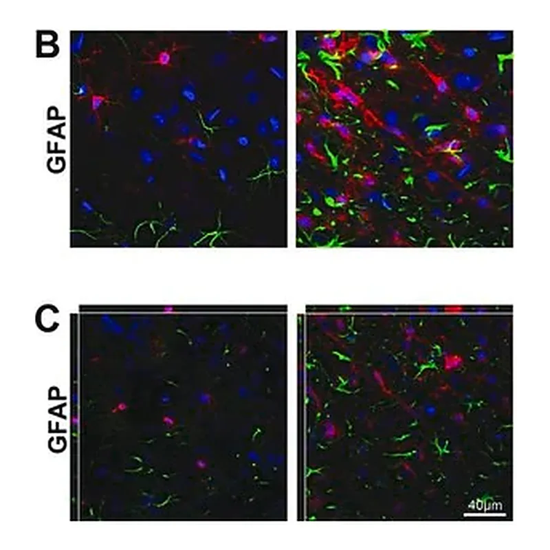 Merck Anti-Glial Fibrillary Acidic Protein Antibody, clone GA5