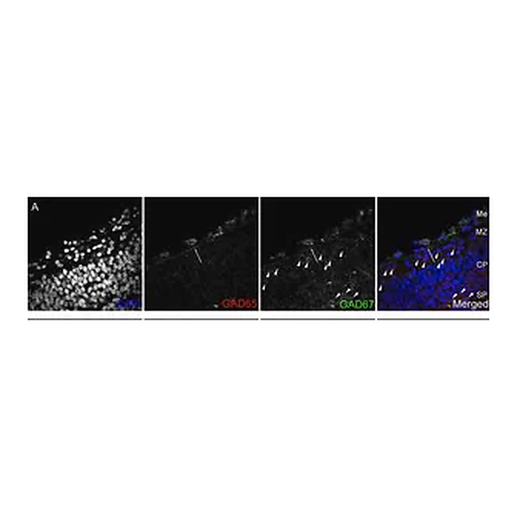 Merck Anti-GAD67 Antibody, clone 1G10.2