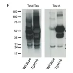 Merck Anti-Tau-1 Antibody, clone PC1C6