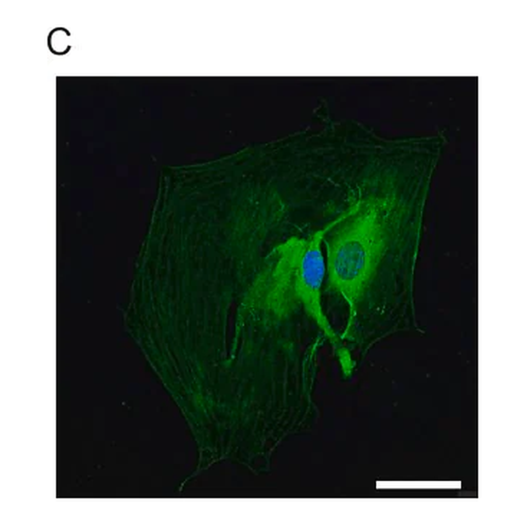 Merck Anti-Glial Fibrillary Acidic Protein antibody produced in rabbit
