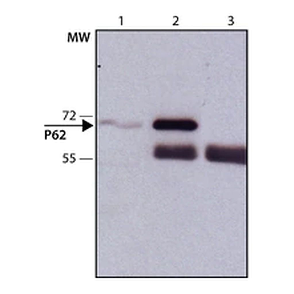 Merck Anti-p62/SQSTM1 antibody produced in rabbit