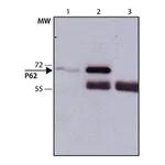 Merck Anti-p62/SQSTM1 antibody produced in rabbit