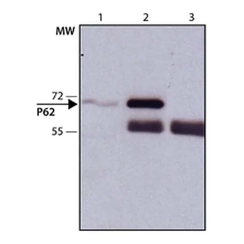 Merck Anti-p62/SQSTM1 antibody produced in rabbit