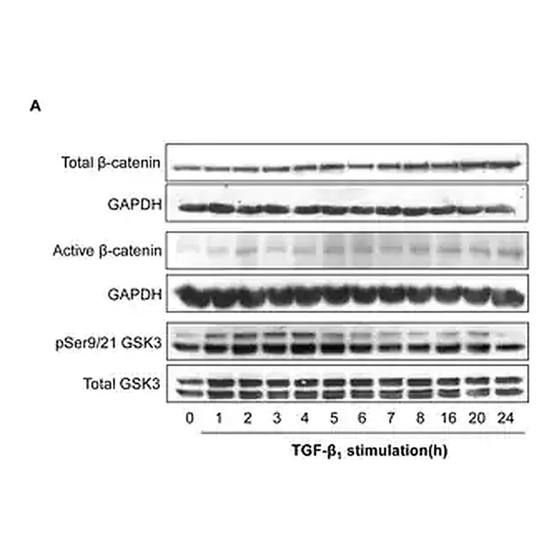 Merck Anti-Active-β-Catenin (Anti-ABC) Antibody, clone 8E7