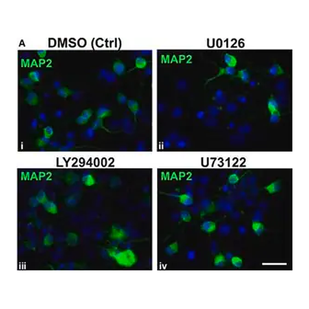 Merck Anti-MAP2 Antibody, clone AP20
