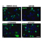 Merck Anti-MAP2 Antibody, clone AP20