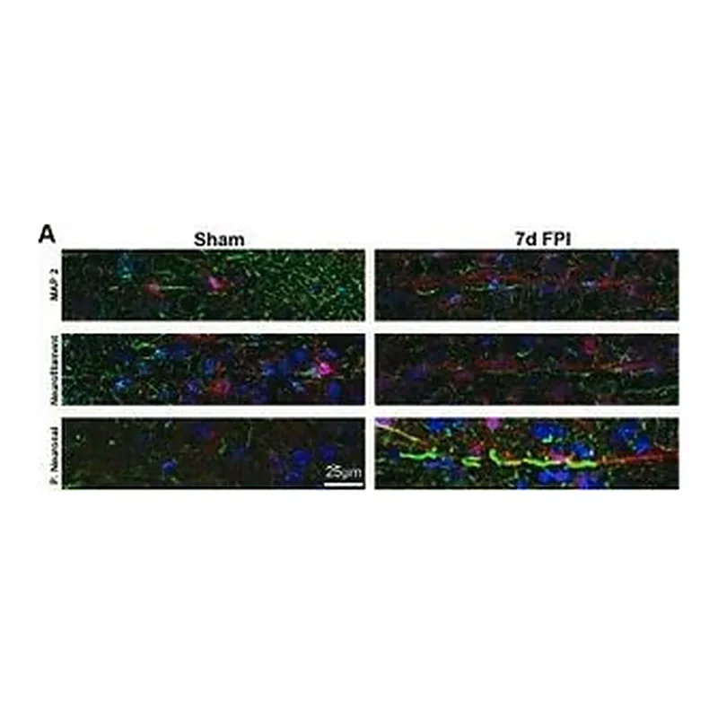 Merck Monoclonal Anti-Neurofilament 200 (Phos. and Non-Phos.) antibody produced in mouse
