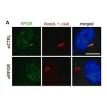 Merck Anti-RPGR antibody produced in rabbit