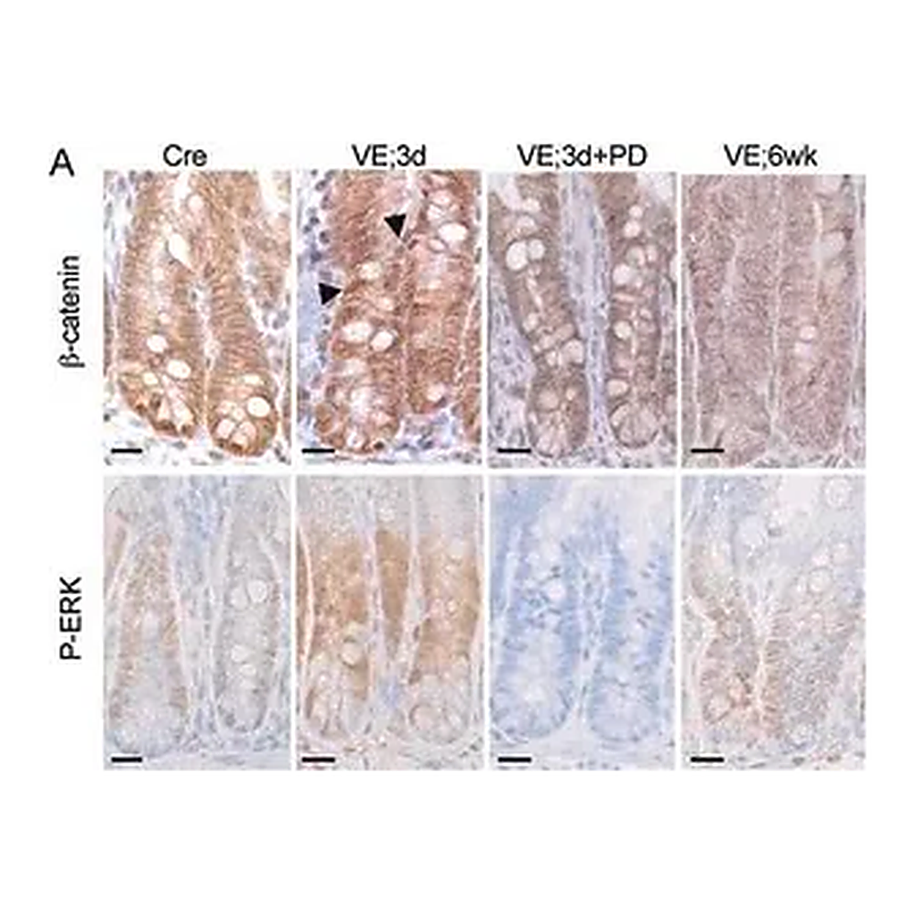 Merck Anti-β-Catenin antibody produced in rabbit