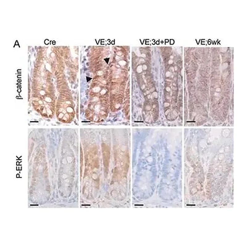 Merck Anti-β-Catenin antibody produced in rabbit