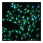Merck Anti-von Willebrand Factor antibody produced in rabbit