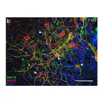 Merck Anti-Substance P Receptor antibody produced in rabbit
