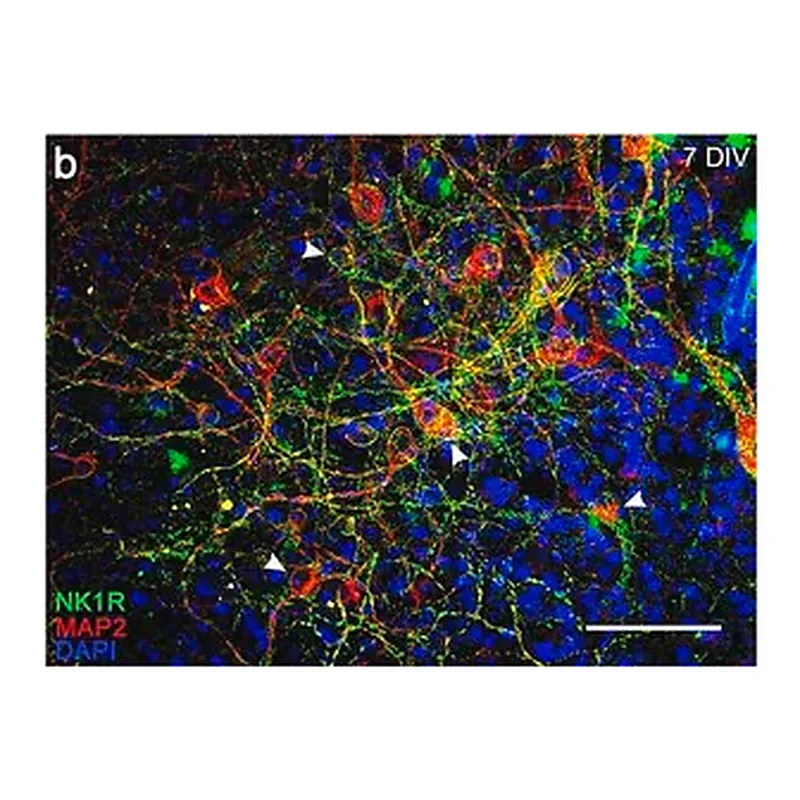 Merck Anti-Substance P Receptor antibody produced in rabbit