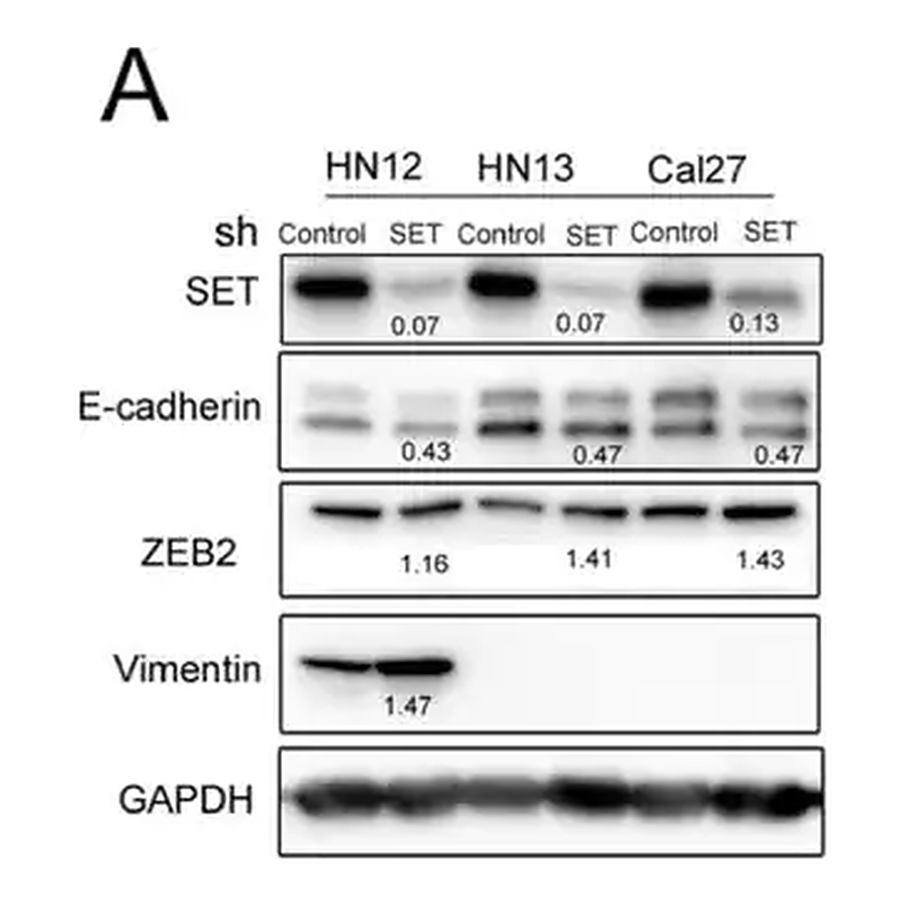 Merck Anti-Vimentin antibody, Mouse monoclonal