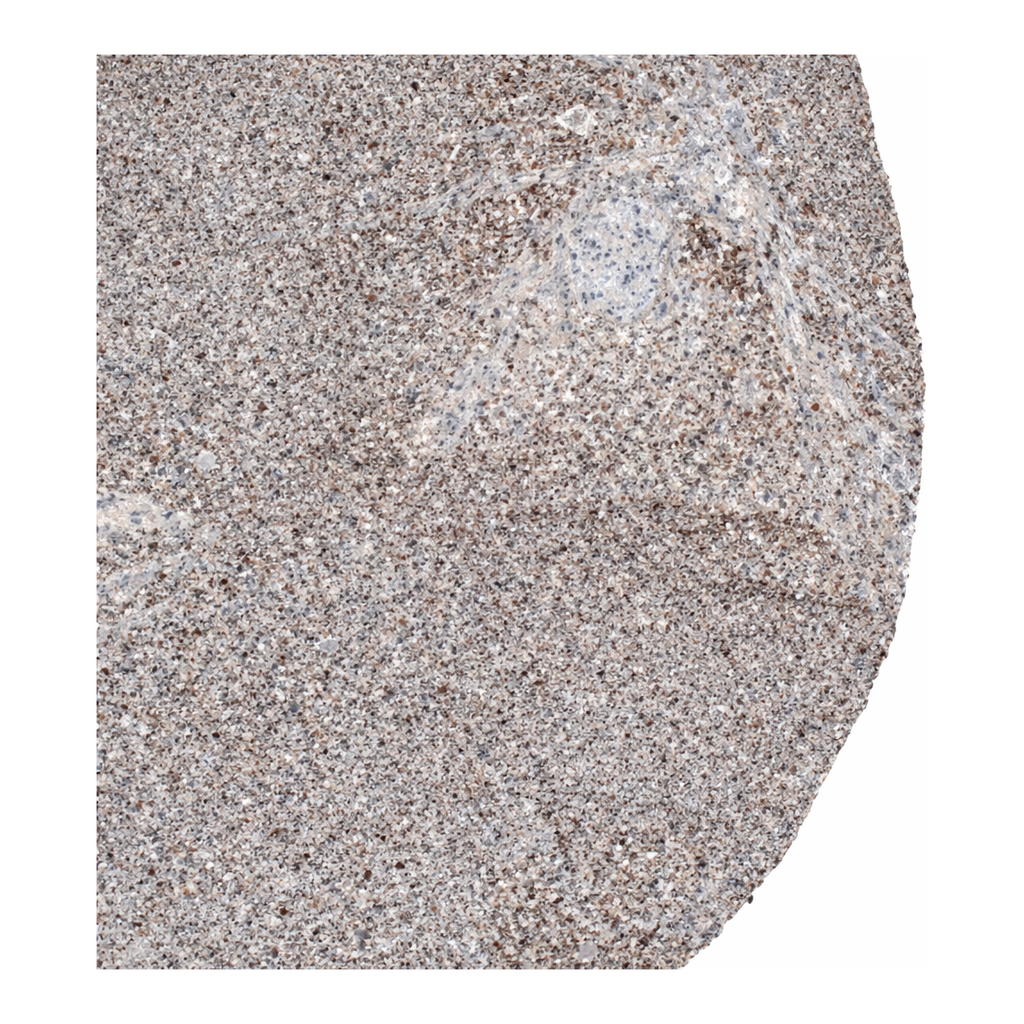 Merck Anti-CXorf21 antibody produced in rabbit