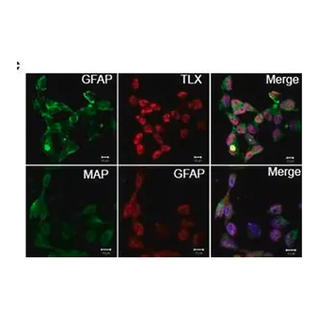 Merck Anti-MAP2 (2a+2b) antibody, Mouse monoclonal