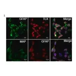 Merck Anti-MAP2 (2a+2b) antibody, Mouse monoclonal