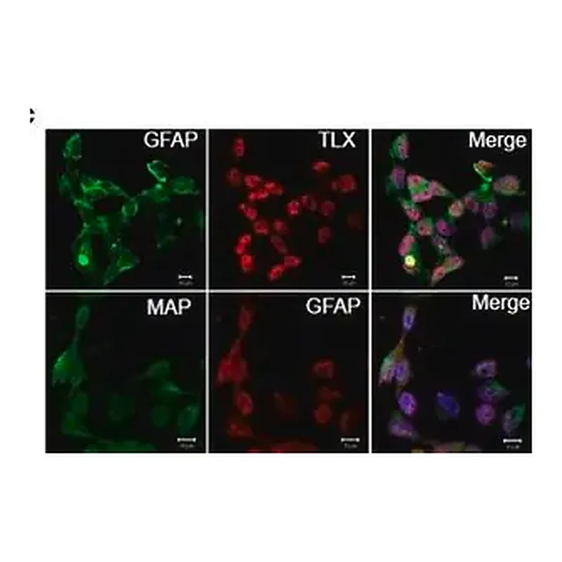 Merck Anti-MAP2 (2a+2b) antibody, Mouse monoclonal