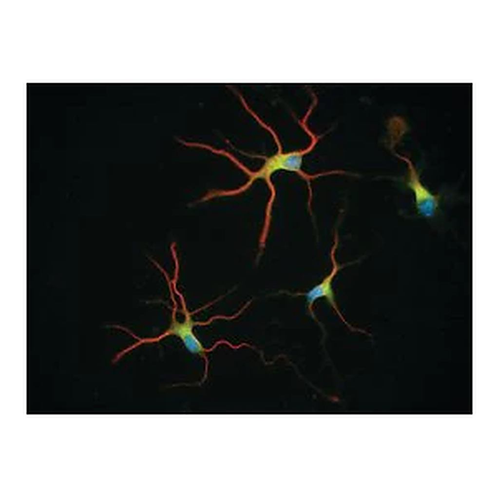 Merck Anti-β-Tubulin Isotype III antibody, Mouse monoclonal
