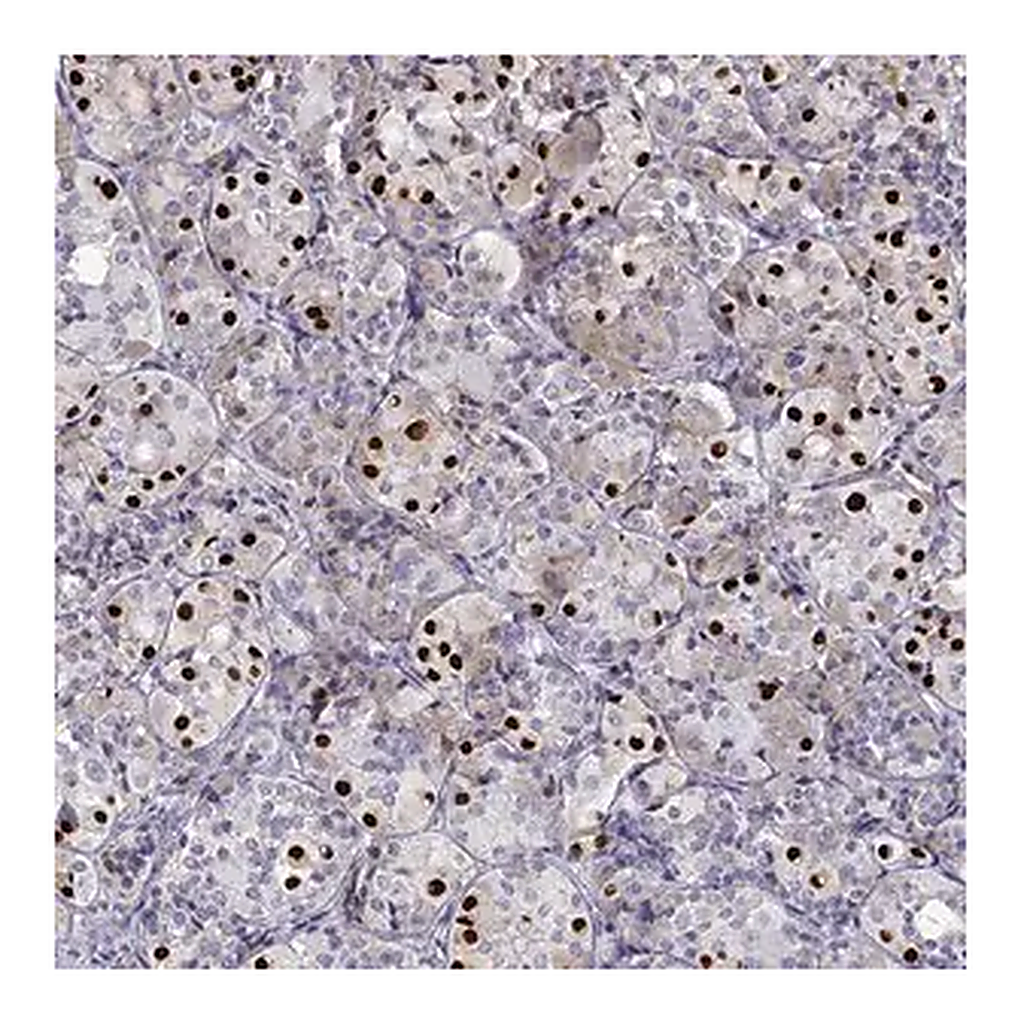 Merck Anti-TBX19 antibody produced in rabbit