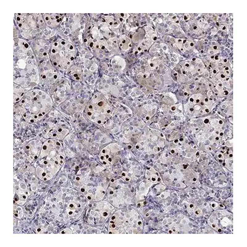 Merck Anti-TBX19 antibody produced in rabbit