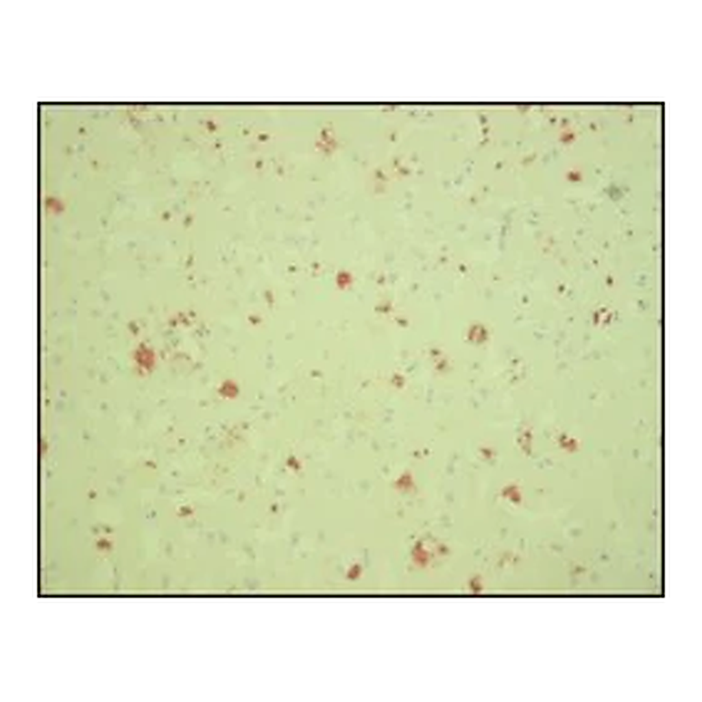 Merck Anti-β-Amyloid antibody, Mouse monoclonal