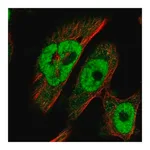 Merck Anti-BRCA2 antibody produced in rabbit