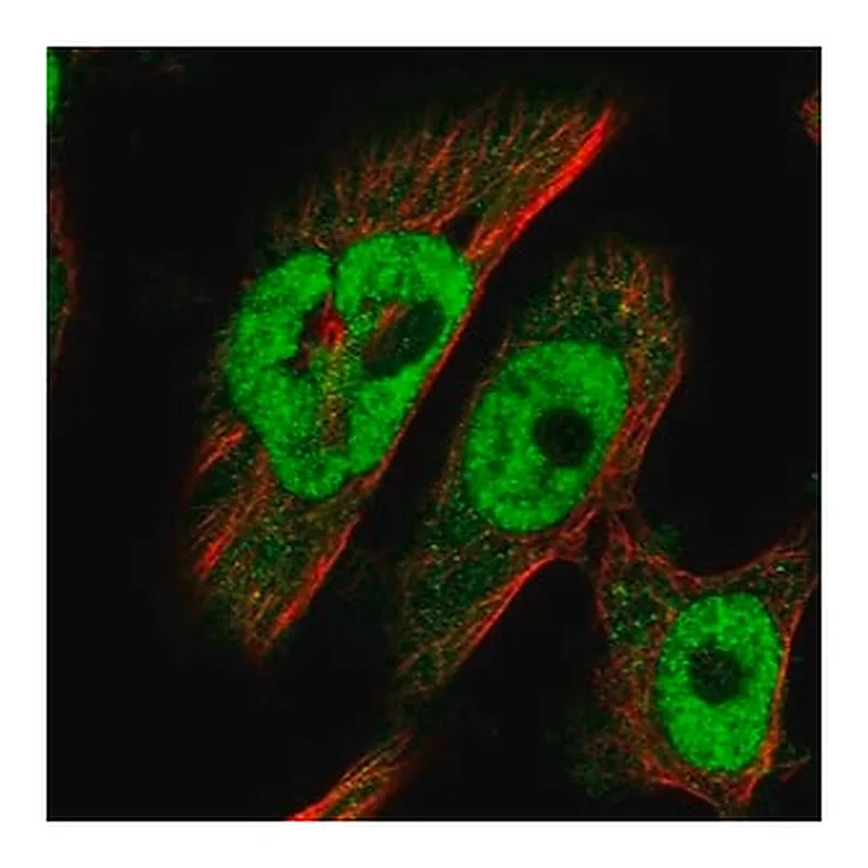 Merck Anti-BRCA2 antibody produced in rabbit
