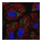 Merck Anti-PNPLA2 antibody produced in rabbit