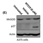 Merck Anti-Mn-SOD Antibody