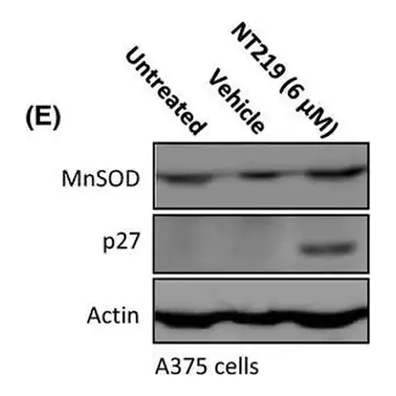 Merck Anti-Mn-SOD Antibody