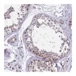 Merck Anti-TCOF1 antibody produced in rabbit