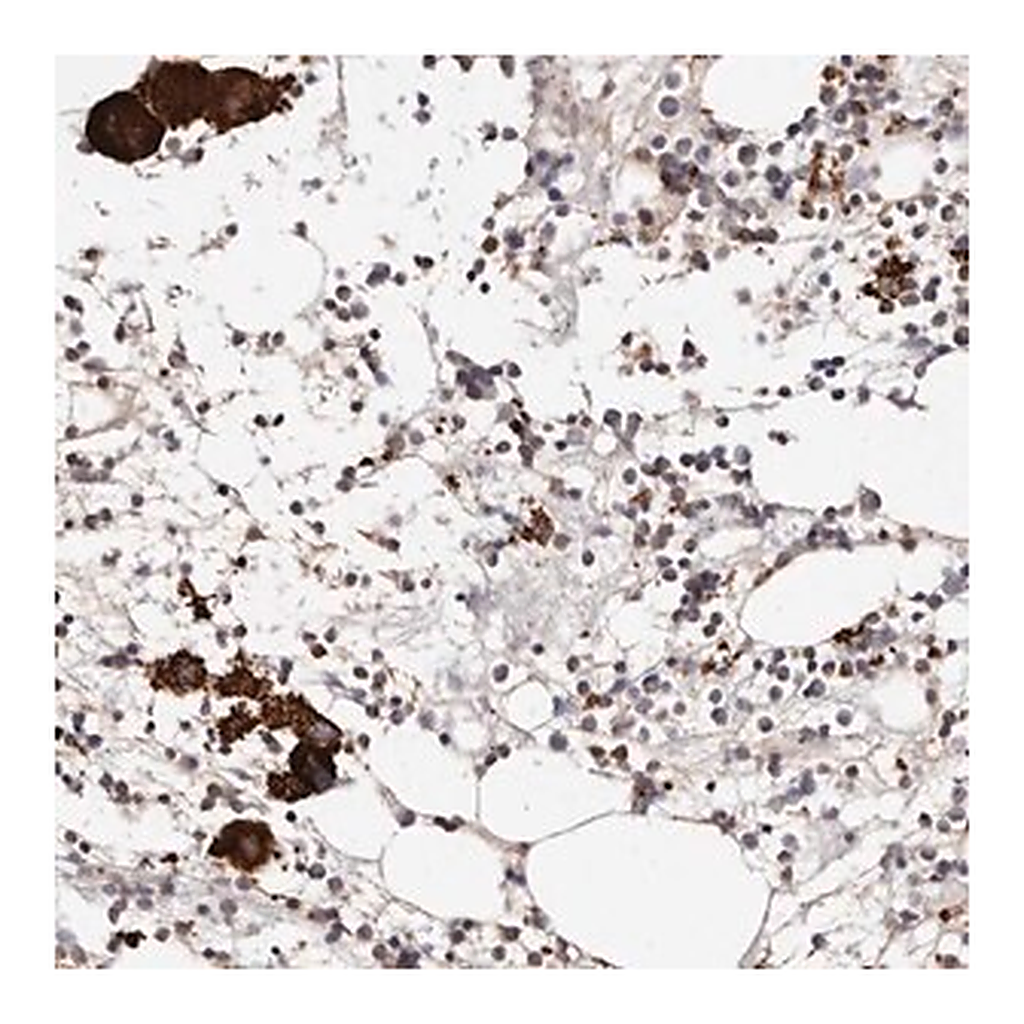 Merck Anti-PTPN22 antibody produced in rabbit