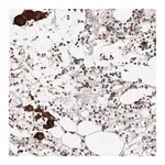 Merck Anti-PTPN22 antibody produced in rabbit